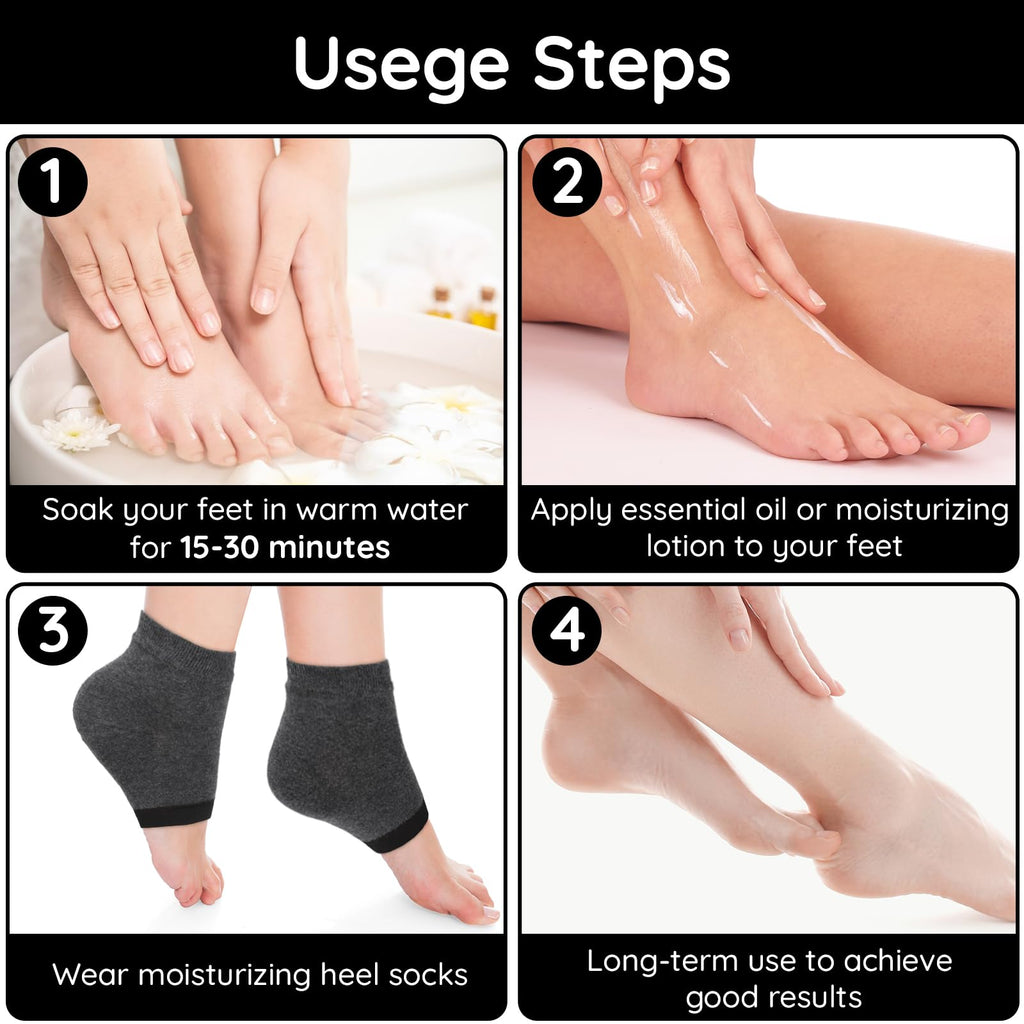 Segbeauty Feet Moisturizing Socks, 8 Counts Moisturizing Gel Heel Socks for Dry Cracked Heels, 4 Pairs Foot Care Moisture Socks for Dry Feet Overnight, Gel Lined Foot Moisturizing Open Toe Socks Black