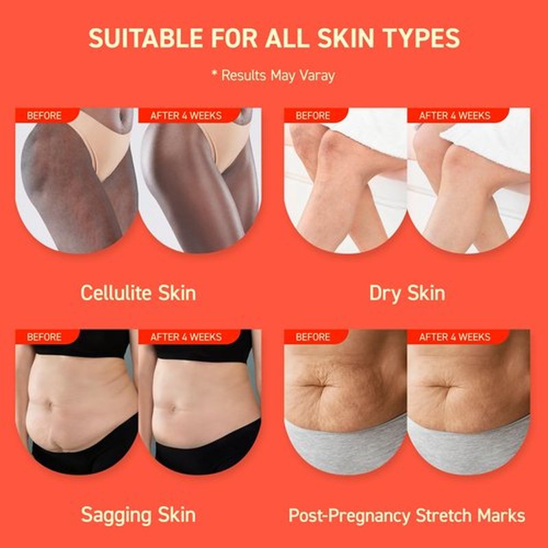 Enaskin Naturals Anti Cellulite Body Firming Cream: