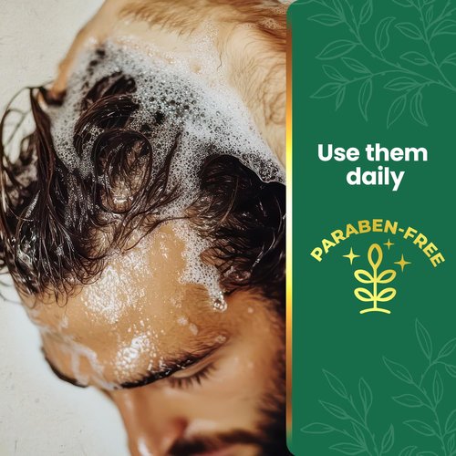 Tío Nacho Mexican Herbs Anti-Hair Loss Shampoo and Conditioner Set with Royal Jelly and Rosemary Extract, Strengthening and Nourishing Routine for Hair Loss, Ideal for Men and Women, 14 fl oz Each