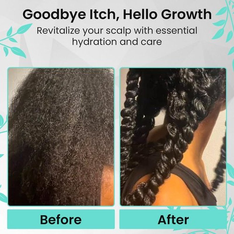 Dorelle Pure Essence Hair Growth Oil for Curly, Coarse & Afro Hair – Sulfate Free Scalp for Hair Growth – Oil with Coconut, Rosemary & Peppermint – Kumquat Scented