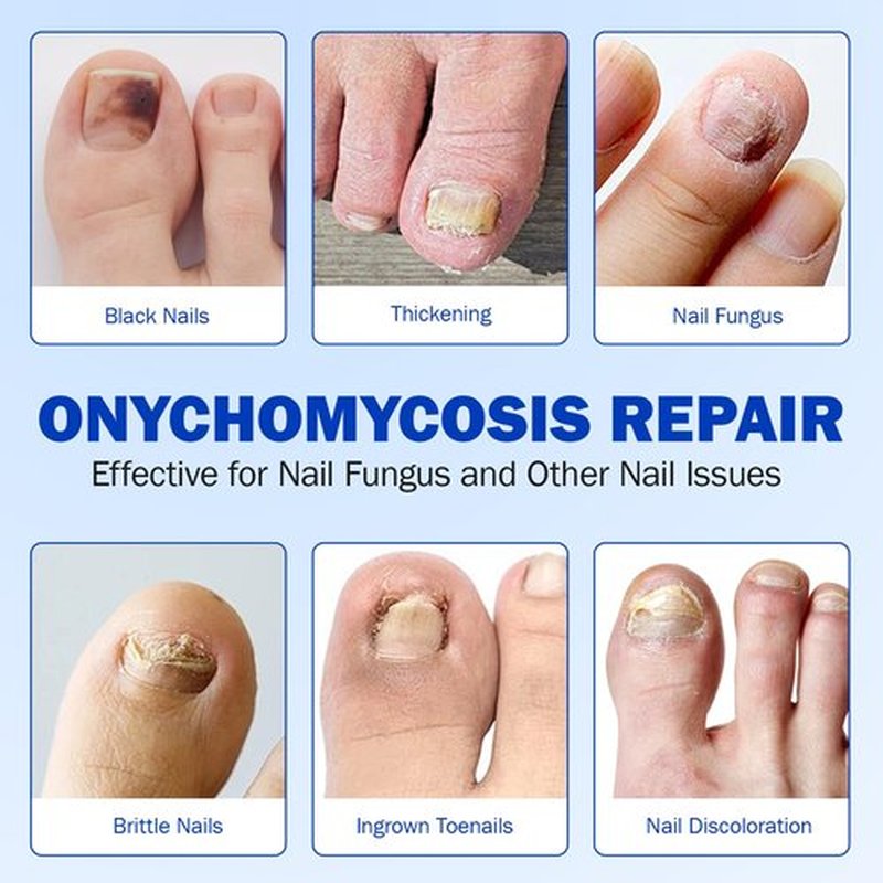 21 PCS Nail Patches ，Toenail Treatment Patch Extra Strength 8-Hour ，Nail Repair Patches,,Nail Repair for Restores Damaged Nails and Appearance of Discolored，Overnight Renewal for Men and Women