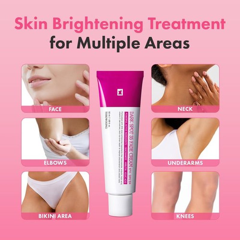 TOSOWOONG Dark Spot 35 Fade Cream, Dark Spot remover with Arbutin, Kojic Acid, Niacinamide, Skin Bleaching Cream for face & body Hyperpigmentation, Discoloration, Korean Skincare 50ml / 1.69 fl. oz.