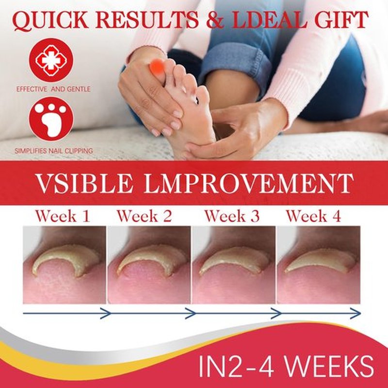 2PCS Ingrown toenail drops,Ingrown Toenail Relief,Easy Trim Ingrown Toenail Tools,Toenail Fluid With Silicone Gel Toe Caps Essential Oil Diffuser,Ingrown Toenail Reliever and Softener Kit