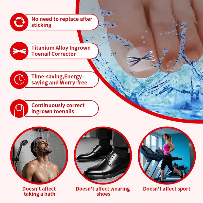 Upgraded Titanium Alloy Ingrown Toenail Corrector with Upgraded 6-Angle Shape,3x Stronger Pull Force,Ingrown Toenail Removal Kit, Ingrown Toenail Treatment for Women and Man (Small Size-6 packs)