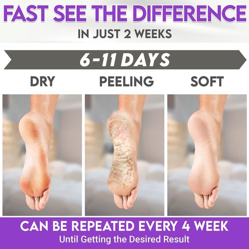 Foot Peel Mask Lavender Moisturizing Exfoliating Foot Masks - Karma Organic Feet Peeling Masks for Dry ed Feet, Remove Dead Skin & Calluses - Removes & Repairs Rough Heels, Dry Toe Skin (Pack of 2)