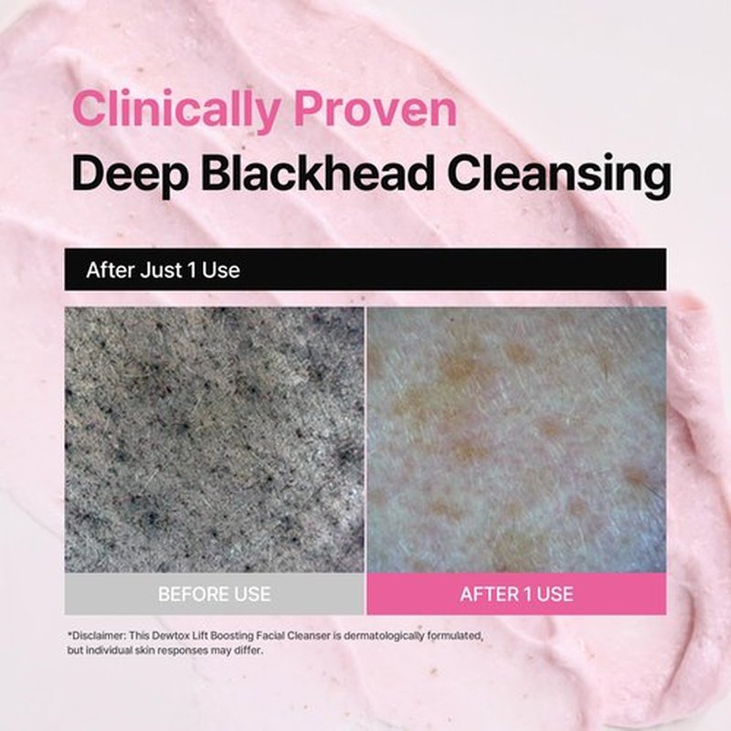 DEWDAP Dewtox Lift Boosting Facial Cleanser, Face Mask, Foaming Cleanser, Skin Enhancement All in One, Face Wash for Sensitive Skin, Korean Skincare (5.07 Fl Oz / 150ml)
