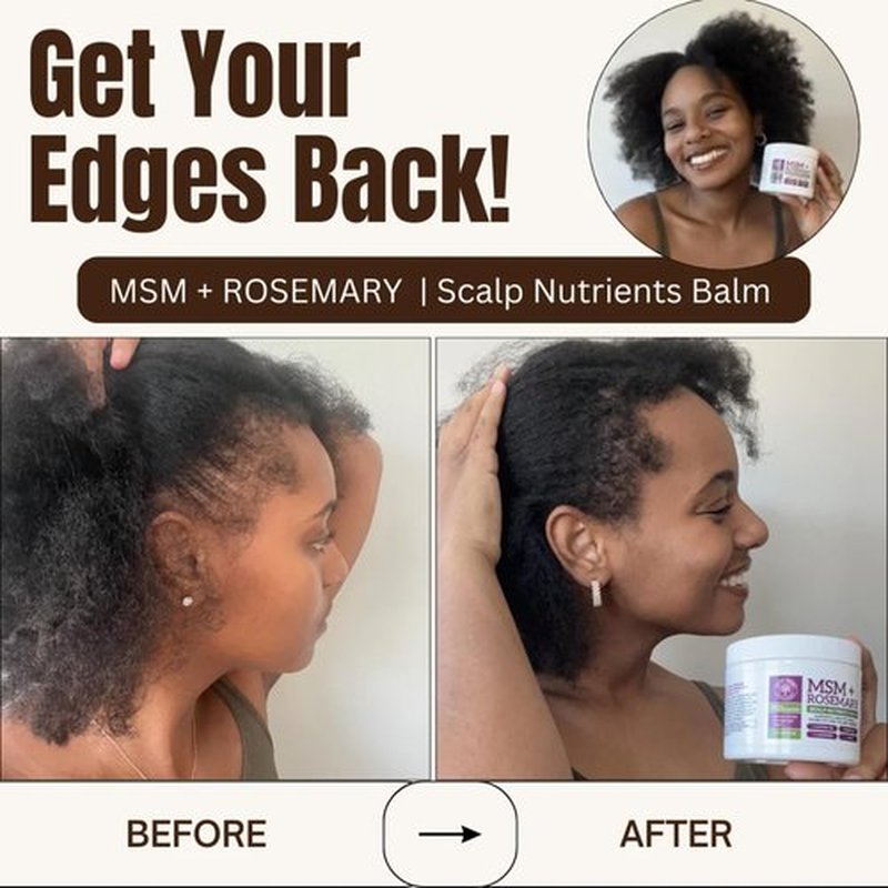 Qhemet Biologics MSM + Rosemary Scalp Nutrients Balm | Scalp Food for Hair Growth | MSM, Rosemary, Bhringraj, Castor Oil & Coconut Oil | For Dry Scalp, Thinning & Slow Growth | Vegan (4 oz)
