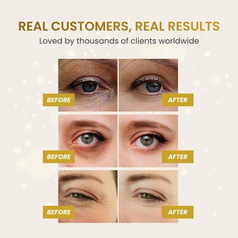 PLANTIFIQUE 24K Gold Under Eye Patches 20 Pairs - Dermatologist Tested - Hydrating Collagen Eye Masks with Hyaluronic Acid for Dark Circles & Puffiness