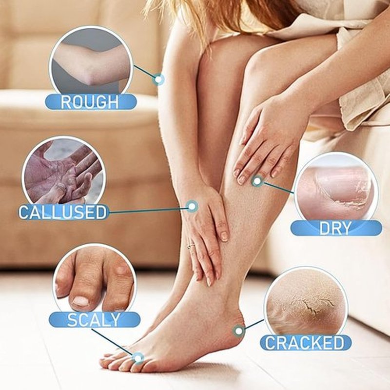 Gireatick Cracked Repair Cream, 2Pcs Cream For Dry Cracked Skin, Peach Cracked Heel Stick, Rolling Use Moisturizing Balm For Dry Cracked Feet Hands And Elbows (40gx 2)
