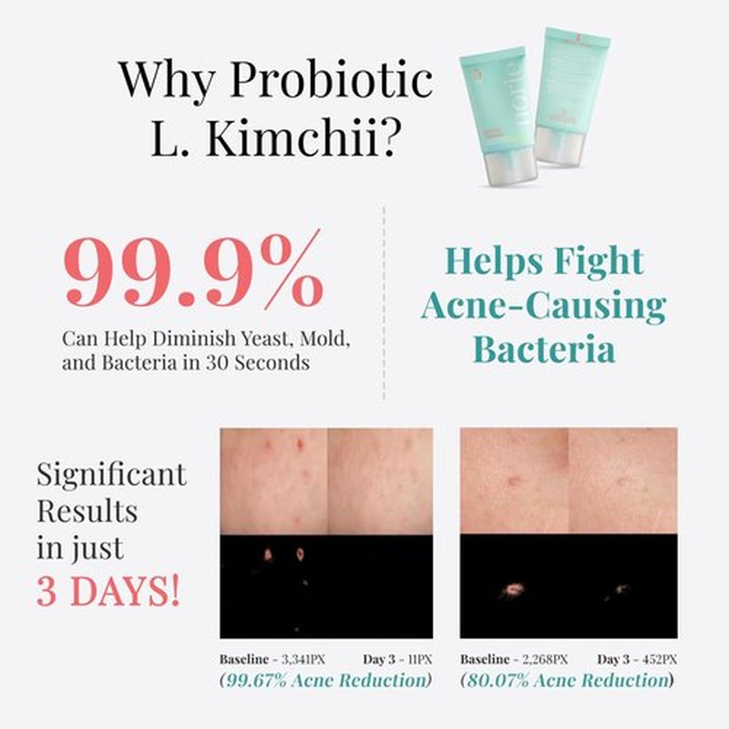 Norie Kimchii Face Wash - Gentle Facial Cleanser for Dry, Oily & Sensitive Skin | Fragrance Free Gel for Clearer Skin 2% Salicylic Acid, Vegan, Unscented 1.7oz