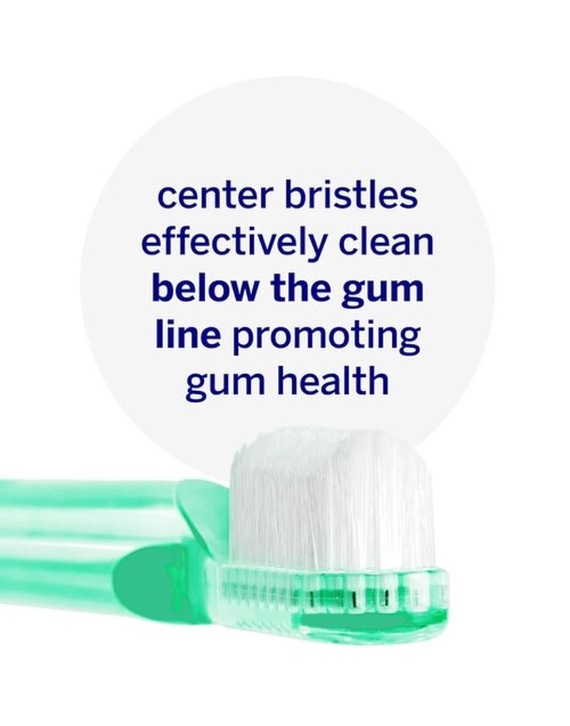Supersmile Toothbrush - New Generation Design with Patented 45° Soft Nylon Bristles | Ergonomic Handle for Optimal Whitening