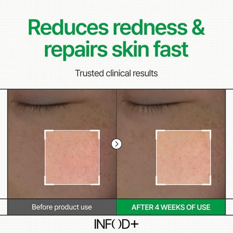 INFODPLUS Korean Skin Care Sensitive Face Cream, Lightweight Moisturizer with Ceramides & Panthenol, Skin Barrier Support & Deep Hydration, Low pH Daily Cream for AM/PM Use, 50ml