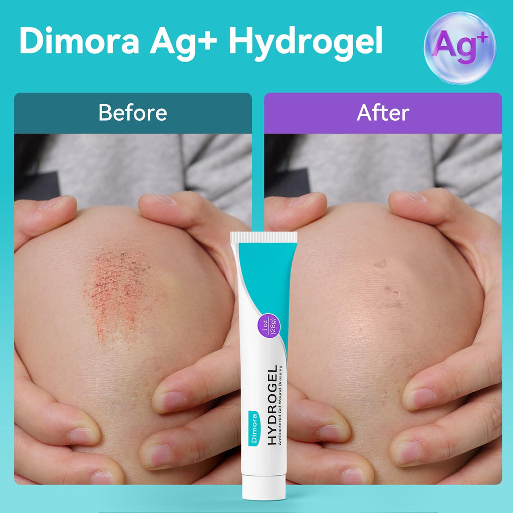 Dimora Silver Hydrogel Gel Wound Dressing-3 Packs 3oz (28gx3), Silver Hydrogel First Aid Ointment for Soothing & Wound Healing, Silver Hydrogel Care for Minor Abrasions, Cuts, Lacerations and Scalds.