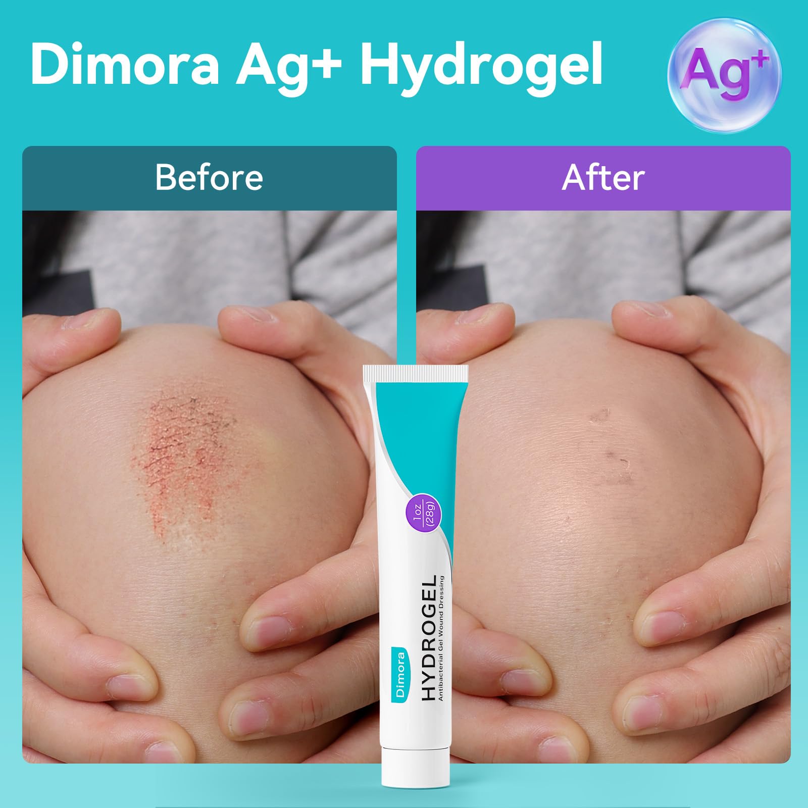 Dimora Silver Hydrogel Gel Wound Dressing-3 Packs 3oz (28gx3), Silver Hydrogel First Aid Ointment for Soothing & Wound Healing, Silver Hydrogel Care for Minor Abrasions, Cuts, Lacerations and Scalds.