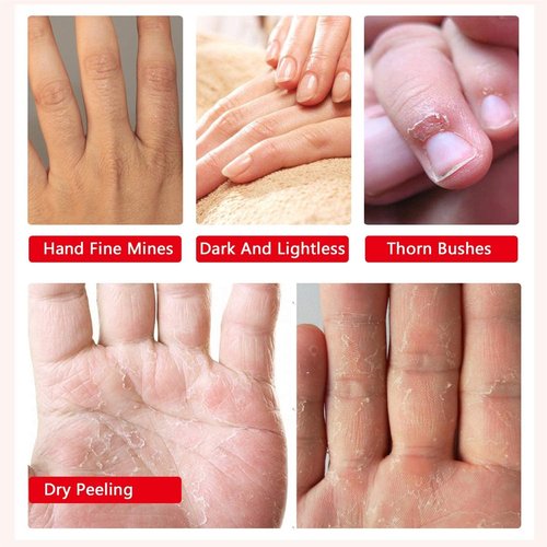 Liefiet Hand Peel Mask Moisturizing Gloves 5Pack, Hydrating Hand Masks Repair Dry Cracked Hands, Skin Moisturizer for Soft and Smooth Touch