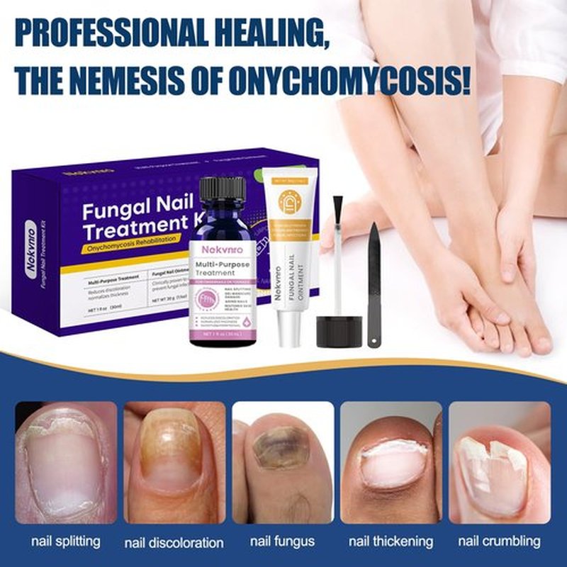 Toenail Fungus Treatment Extra Strength,Nail Fungus Treatment for Toenail,Fungus Nail Treatment Liquid 30ML and Fungal Nail Repair Cream.