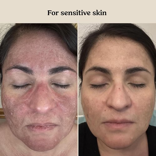 Roe Wellness Baby Cream & Serum Power Pair - Hydrating Skincare for All Ages | Body & Face Care for Toddlers & Newborns