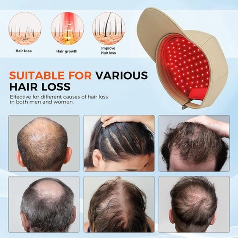 Red Light Hair Growth Cap - Hair Growth Cap for Men Women - Lasers & LED Light Therapy Cap - FDA Cleared Rechargeable Hair Loss Treatment Device for Fast Thickening - Ideal for Home Use