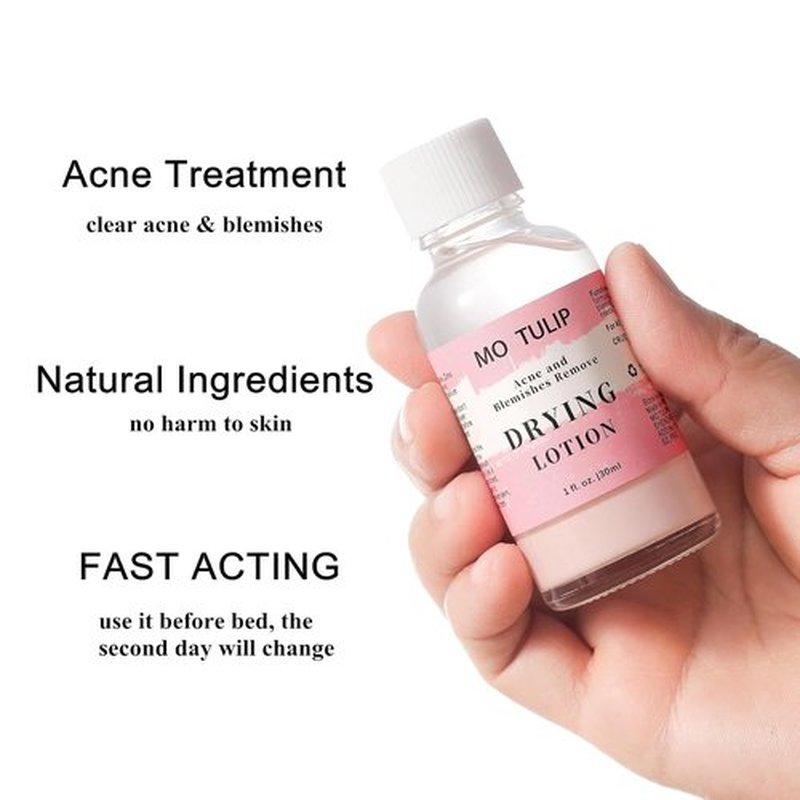 MO TULIP Acne Drying Lotion - Overnight Spot Treatment for Face & Body | 1 OZ Pimple Solution