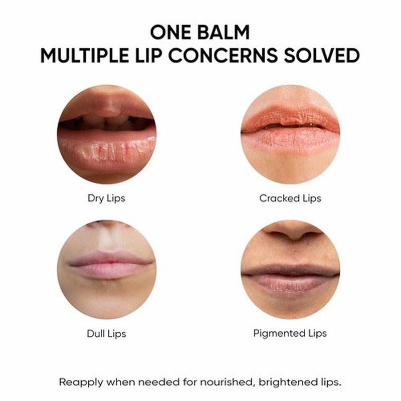 Masofta Shea Butter Lip Balm - Smooth, Clear Lips with Kojic Acid & SPF 30 | 0.52 oz (15g)