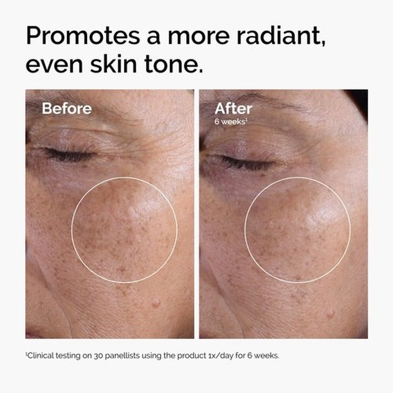 The Ordinary Glycolic Acid 7% Exfoliating Toner - Brightening Daily Formula for Even Skin Tone