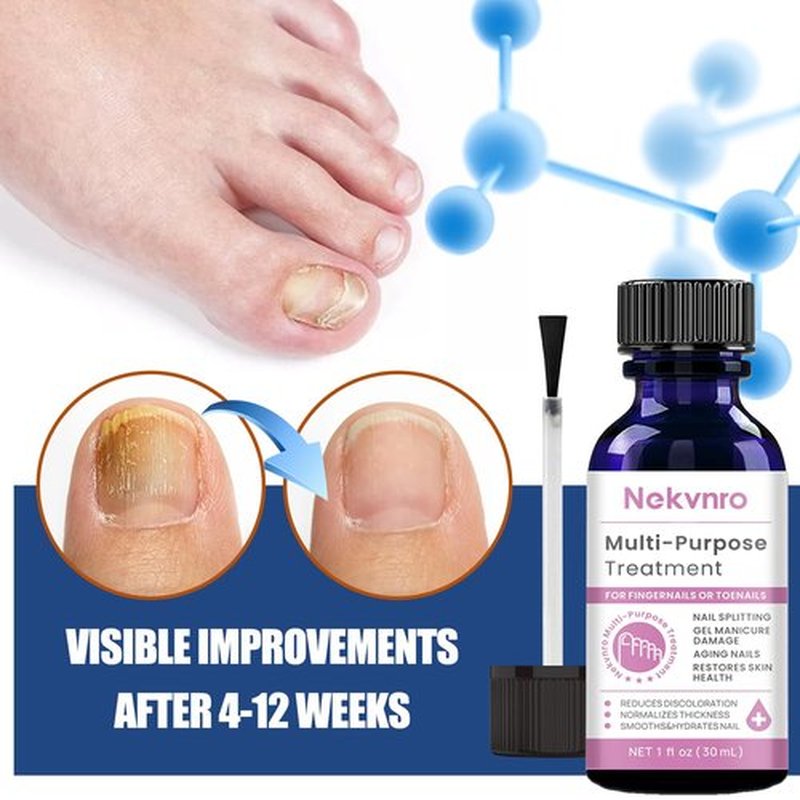 Toenail Fungus Treatment Extra Strength,Nail Fungus Treatment for Toenail,Fungus Nail Treatment Liquid 30ML and Fungal Nail Repair Cream.