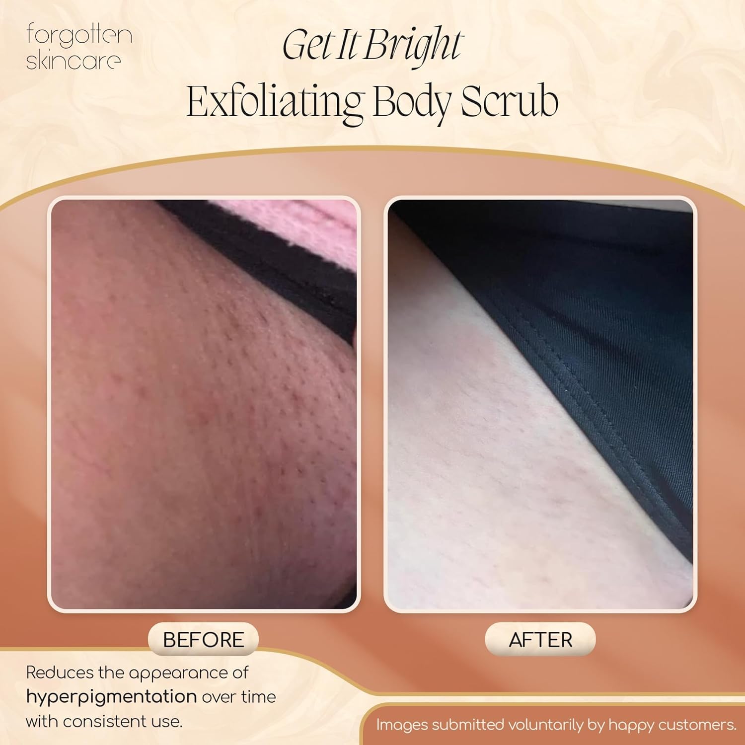Forgotten Skincare Get It Bright Exfoliating Body Scrub with Glycolic Acid & Pumice for Dark Armpits, Bikini Area, KP Bumps, Rough Skin – Daily AHA Polish to Smooth, Soften & Prep Sensitive Areas