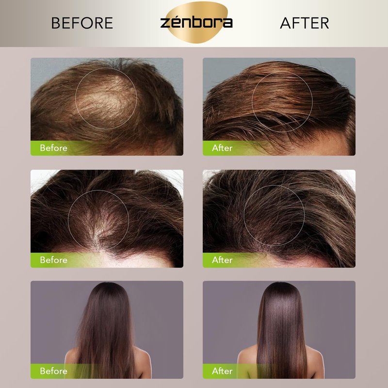 Zenbora Hair Vitamin Serum, Vitamin E Oil Capsules for Hair Growth, Body Skin Hydration & Anti-Oxidant & Anti-Aging, Leave-in with Argan Macadamia/Avocado/Moroccan Oil, Easily Absorb-40 Count