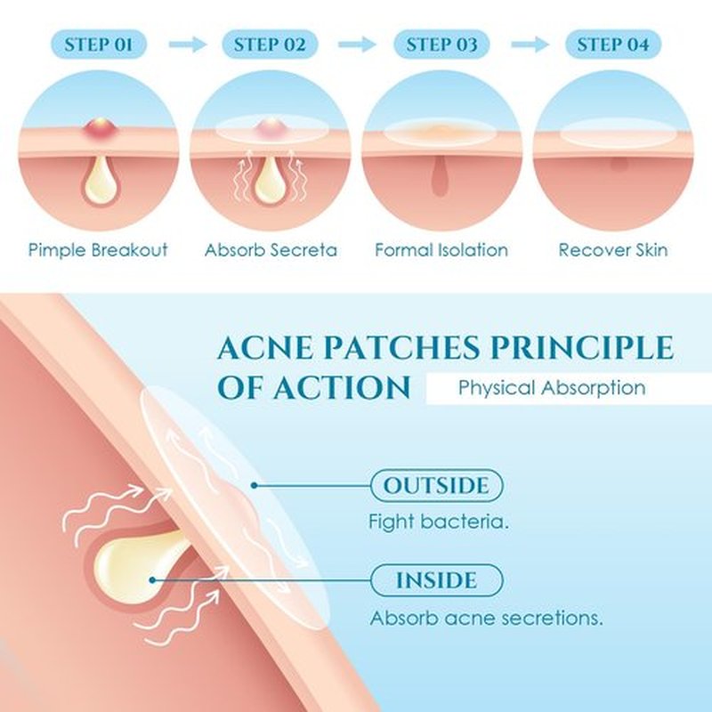 Pimple Patches Acne Patches, PITHER Day and Night Hydrocolloid Patch for Covering Zits and Blemishes Invisible Zit Patches with Tea Tree Oil, Salicylic Acid, Centella Asiatica (288 Count, 2 Size)