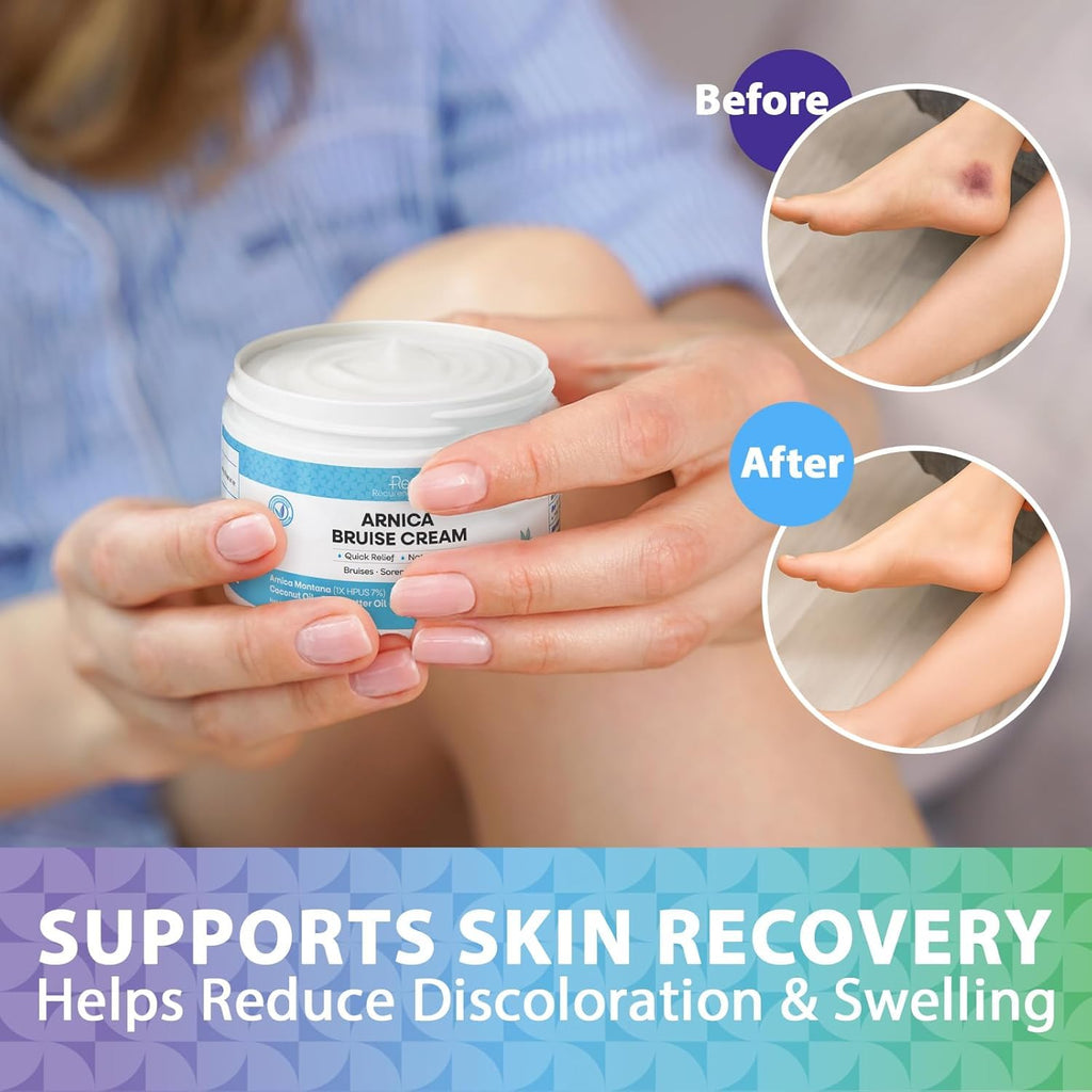 Recuren Plus Arnica Bruise Cream Extra Strength: Rapid Relief for Bruising Swelling Soreness Pain on Thin Skin - Potent Arnica Montana with Vitamin K Coconut Shea Butter - Face & Body