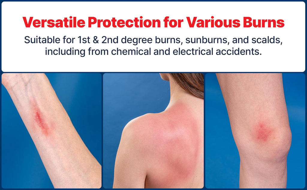 BurnFix® Hydrogel Burn Spray – 120 ml Instant Cooling Relief for 1st & 2nd Degree Burns, Sunburns & Scalds | Doctor-Recommended Moisturizing First Aid Essential for Kids & Adults