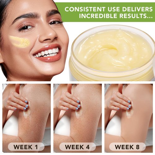 Btefls Pure Organic Shea Butter Raw, Unrefined Body & Face Butter - 100% Natural Vitamin A, E & F - Long-Lasting Hydration for Dry Skin, Hair Care, 7.8 oz