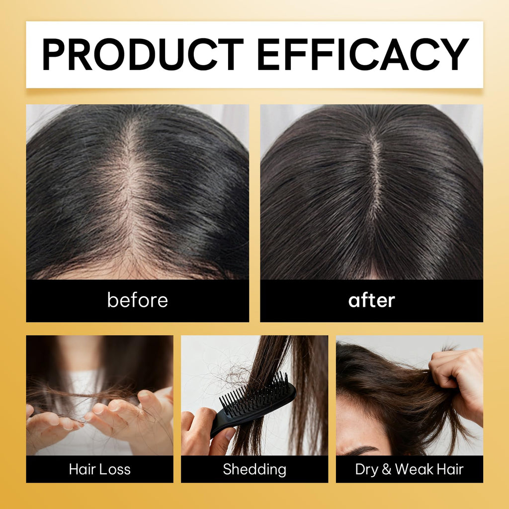 Nuspa Rejuvenating Revitalizing Anti Hair Loss Ampoules Treatment,Stabilizing Barrier Scalp, Follicles Hair Growth Serum For Men Women