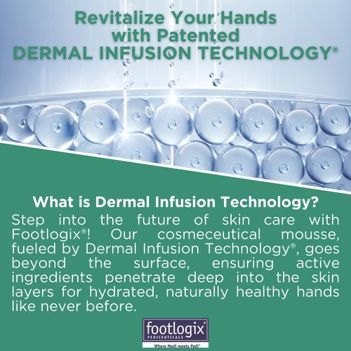 Footlogix Hydrating Hand Mousse with Dermal Infusion Technology® | Deep Hydration for Dry Hands | Urea-Enriched Formula | Fast-Absorbing | 4.23 ozl/119.9 g/125 ml