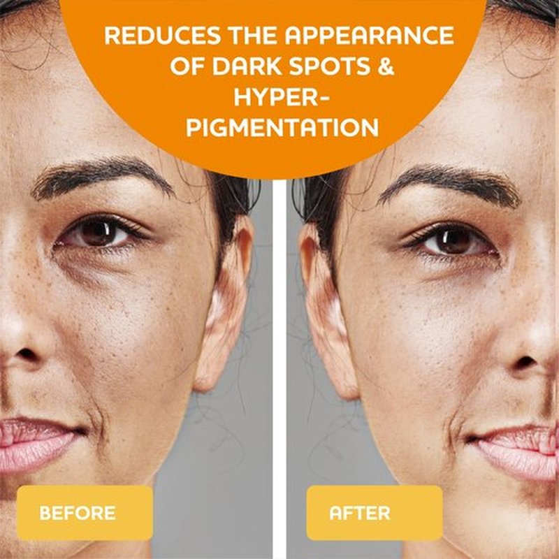 Bare Evoke Vitamin C Serum with Hyaluronic Acid, Niacinamide & Natural Extracts – Hydrating & Brightening Face Serum – Helps reduce the Look of Dark Spots, Dullness & Pores – For All Skin Types