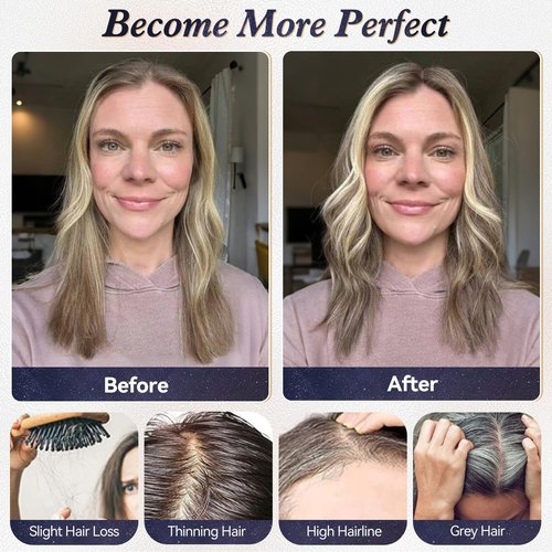 starluck 10 Inch Real Human Hair Topper for Women - 10 Inch No Bangs Topper with 3x4.5 Inch Swiss Lace Base, for Thinning Hair & Gray Root Coverage (Salt Papper)