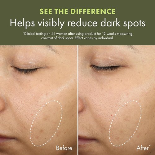 Origins Mega-Mushroom Dark Spot Serum - Reduces Hyperpigmentation & Acne Marks | Enriched with Vitamin C & Reishi, 1 Fl Oz