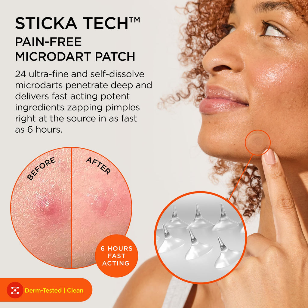 ZitSticka Killa Microdart Pimple Patches for Face - Most Potent Pimple Patch with Fast-Acting Microdarts - For Deep, Early-Stage Zits with Salicylic Acid - Regular 4 Count with Cleaning Swab