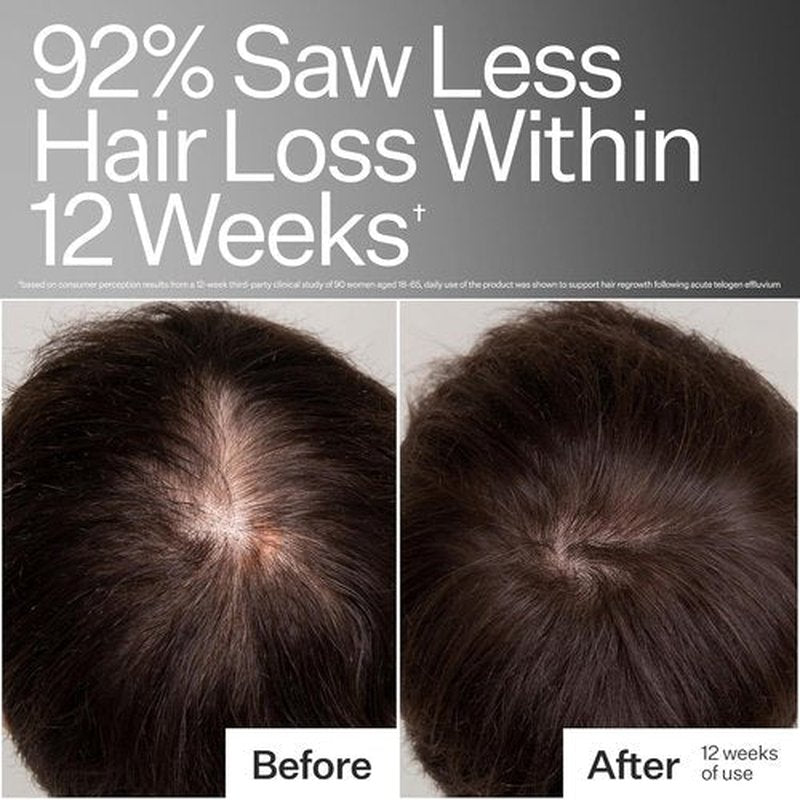 Act+ Acre Cold Processed Stem Cell Peptide Treatment - Boost Hair Density with Grape Stem Cells & Peptides | Vegan, 3 Fl Oz