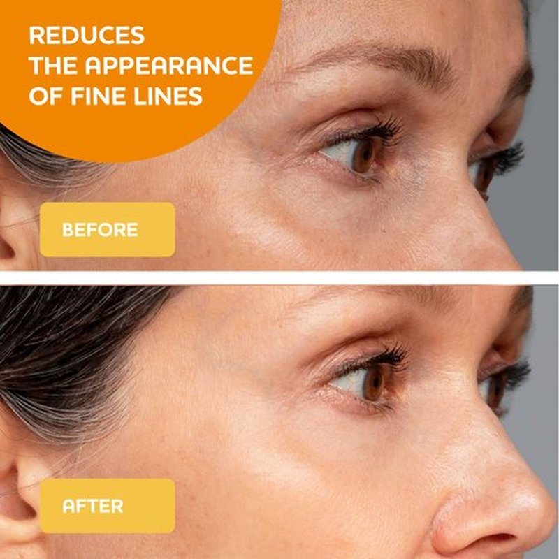 Bare Evoke Vitamin C Serum with Hyaluronic Acid, Niacinamide & Natural Extracts – Hydrating & Brightening Face Serum – Helps reduce the Look of Dark Spots, Dullness & Pores – For All Skin Types