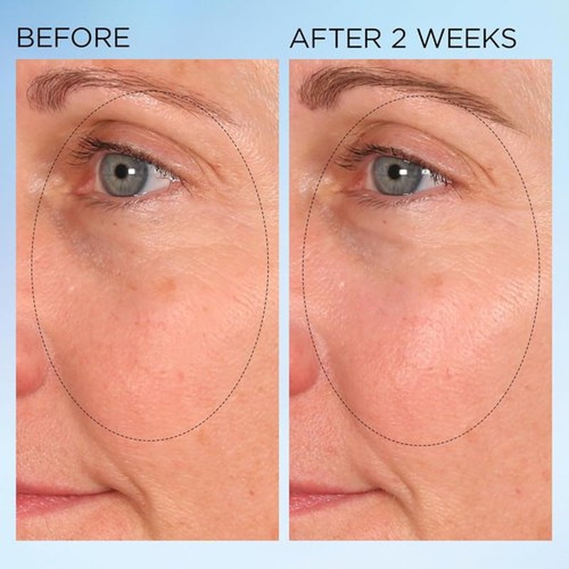Elizabeth Arden Dark Spot Corrector Capsules - Vitamin C Serum for Radiant Skin & Even Tone