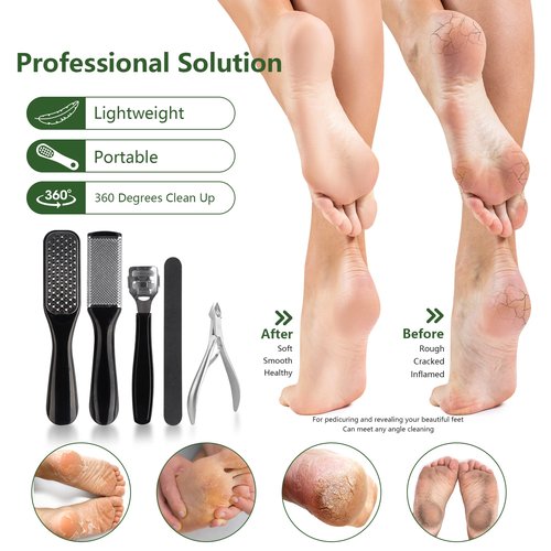 Professional Manicure and Pedicure Tool Kit Professional Exfoliation Foot File Set for Women and Men at Home Or Travel Or Salon to Foot Care (BlackB-30PCS)