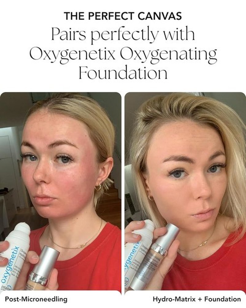 Oxygenetix Oxygenating Hydro-Matrix | Lightweight Aloe-Based Face Moisturizer with Hyaluronic Acid - 2.54oz for Sensitive Skin
