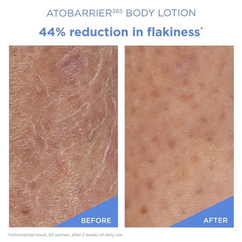 AESTURA ATOBARRIER365 Body Lotion - Fast-Absorbing Ceramide Moisturizer for Dry, Sensitive Skin | 400 mL / 13.5 fl oz