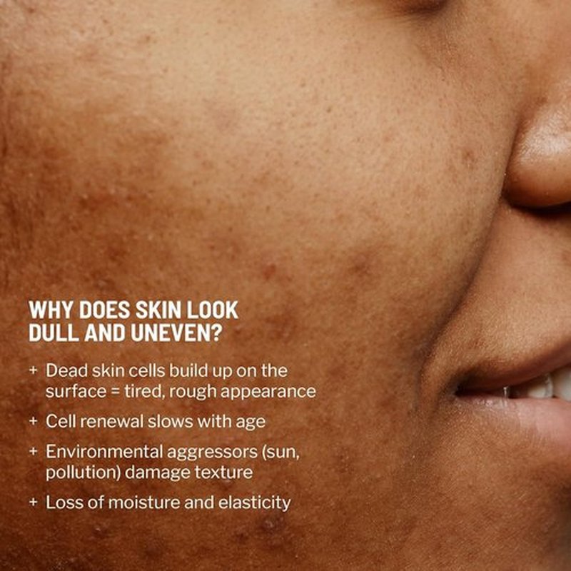 Dr. Brandt Microdermabrasion Exfoliator - Travel Size 0.7 oz | Refines Texture & Minimizes Fine Lines
