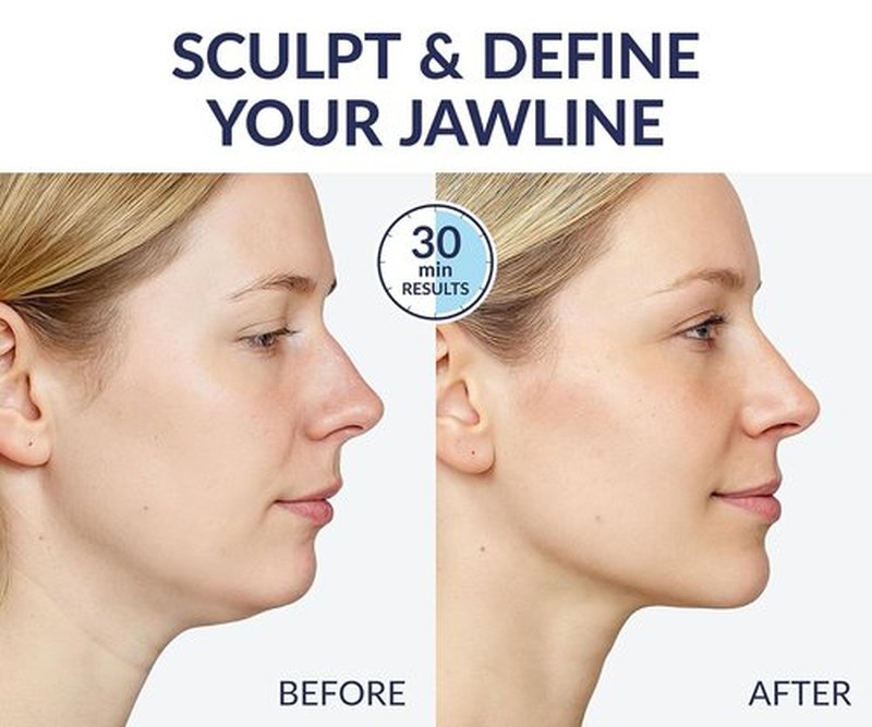 Stylia V Line Lifting Collagen Mask - Firm & Contour Jawline with Hyaluronic Acid - 10PC Neck Tightening Mask