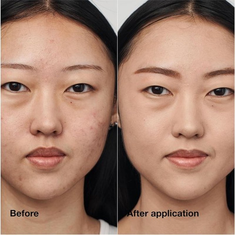 Clinique Even Better Clinical Serum Foundation - Full Coverage, Hydrating SPF 25 with Vitamin C & Hyaluronic Acid for Oily Skin