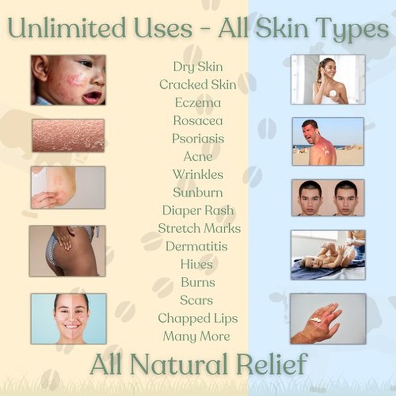 Reroot Organics Beef Tallow Balm for Skin | NAKED TALLOW BALM | 1 Ingredient - 100% Grass Fed Grass Finished Tallow | Whole Body & Face Moisturizer | Whipped | Dry Skin, Eczema, Rosacea, (2oz)