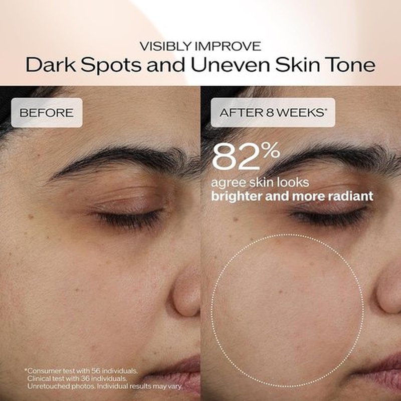 Shiseido Benefiance Brightening & Wrinkle Smoothing Cream - Plant-Based Retinol Moisturizer for Dark Spots & Wrinkles - 24HR Hydration, Non-Comedogenic
