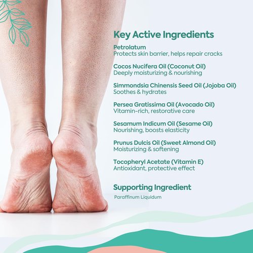 Clasy Care Foot Moisturizing Cream – Hydrating Heel & Foot Cream with Vitamin E and Avocado Oil – Softens Dry, Rough Skin – Nourishing Daily Foot Care, 100 ml